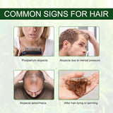 Rosemary Hair Growth Oil