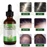 Rosemary Hair Growth Oil